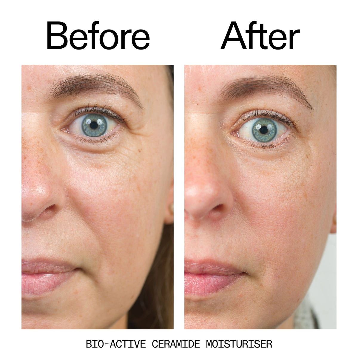 barrier-boosting-trio-a3 Bio-Active_Before_After_2000x2000_600947b4-e8c5-425a-9155-fc15bc83aa12.jpg