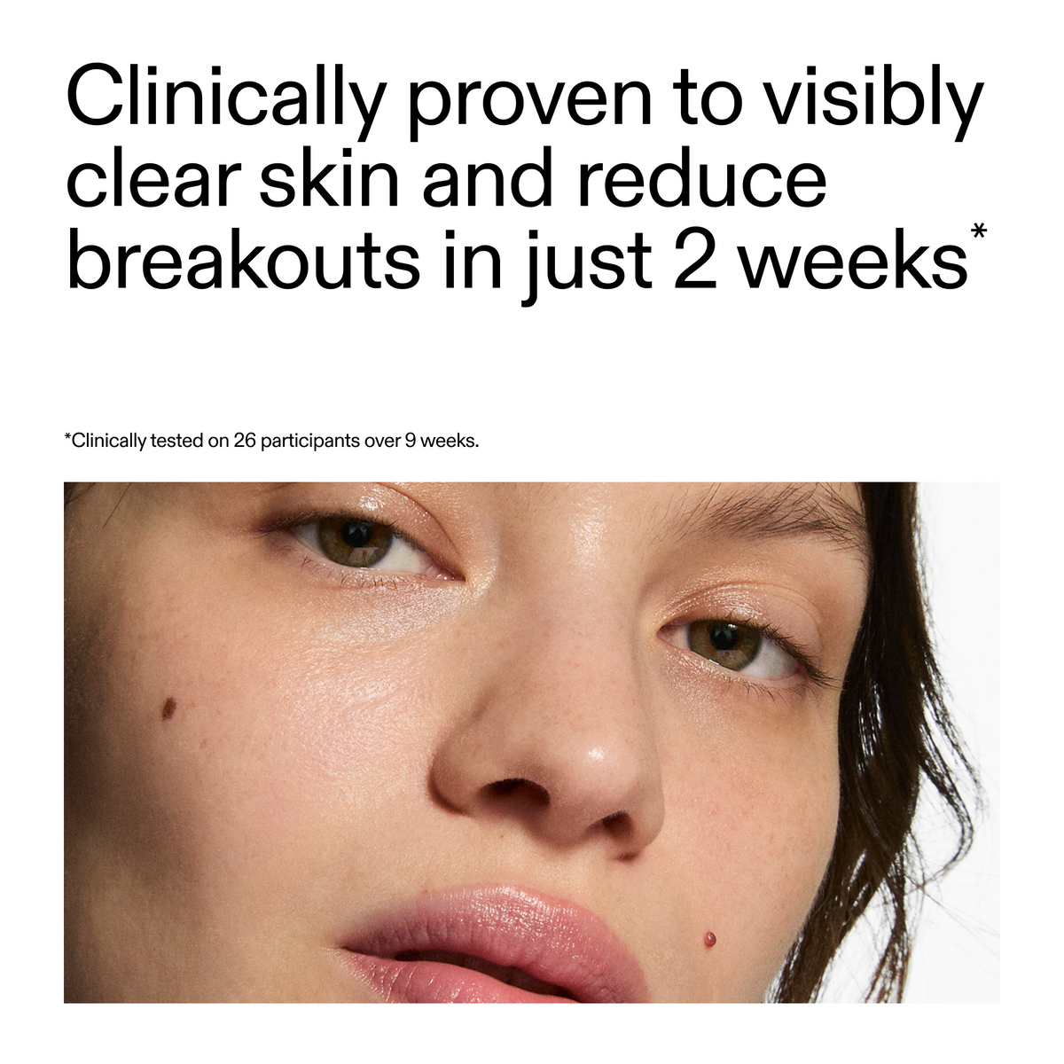 360-acne-clearing-duo-c8 360_Serum_Key_Claim.png