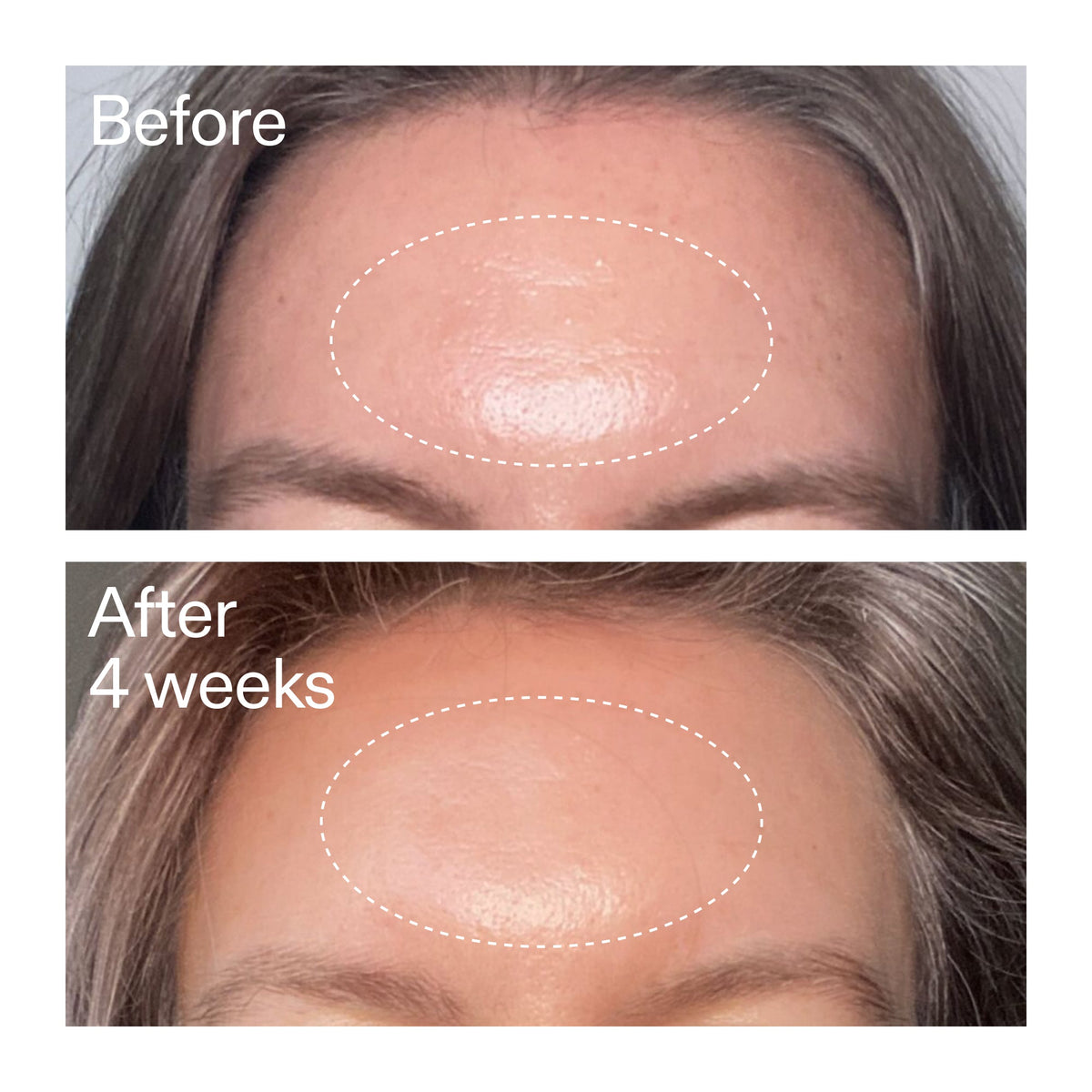 advanced-0-2-retinal-serum-duo-d3 AdvancedRetinal_BeforeAfter1_2000x2000_4e9c798a-f30e-45b8-a34a-7c4740f2f2cb.jpg