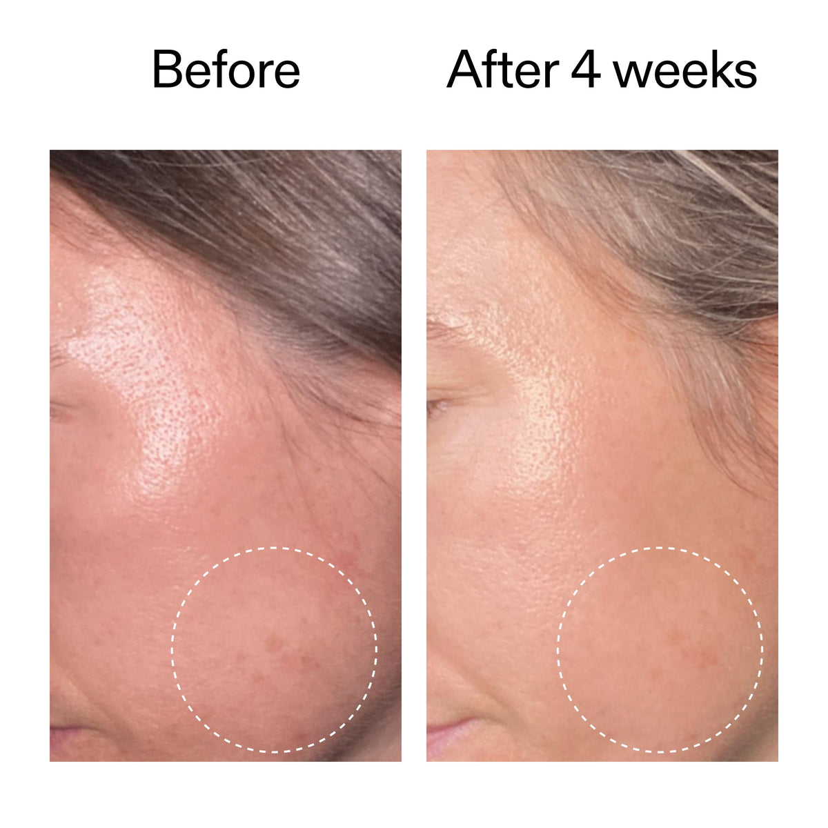 advanced-0-2-retinal-serum-duo-d3 AdvancedRetinal_BeforeAfter2__2000x2000_8ef75542-2316-4814-81ee-0f66a85912bc.jpg
