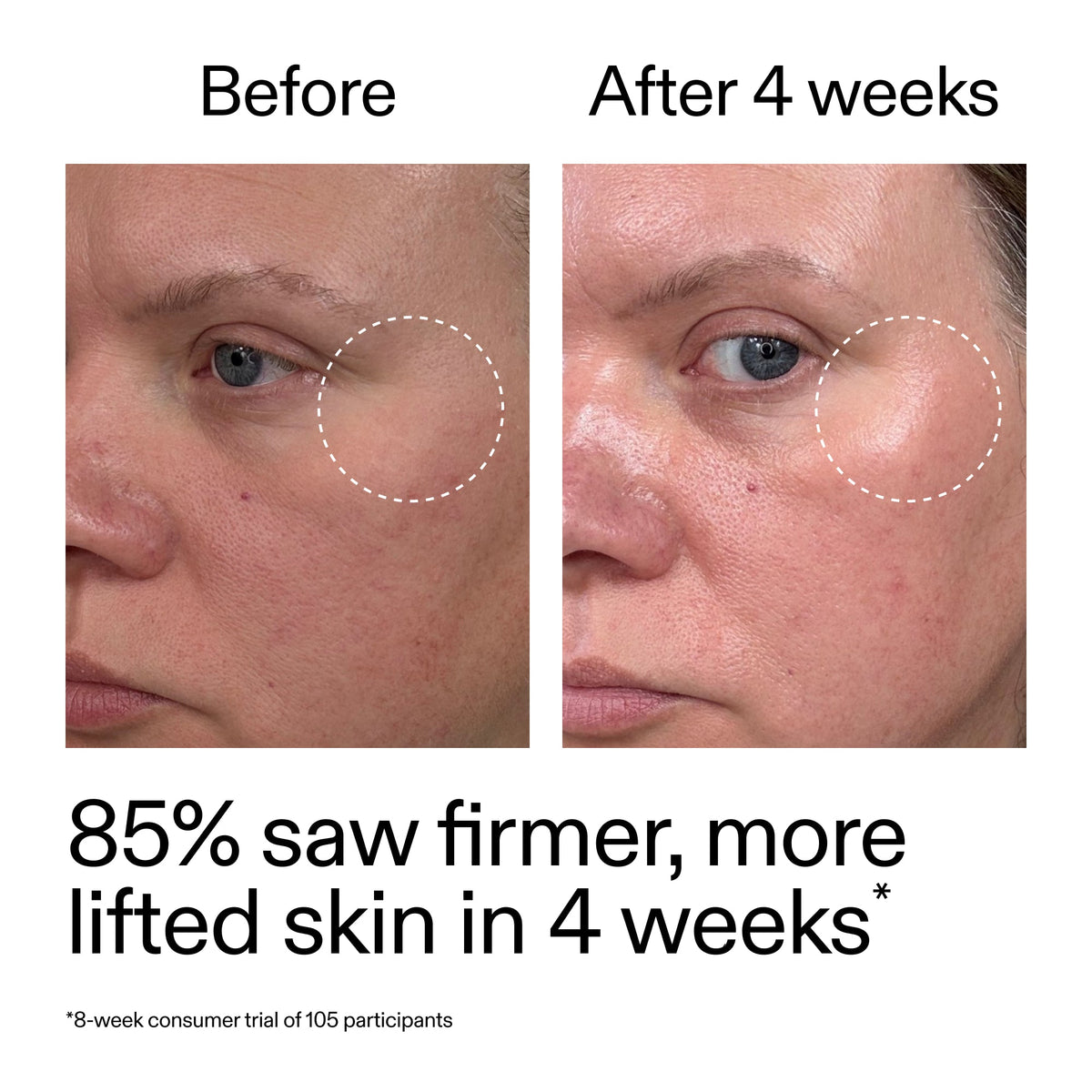 advanced-0-2-retinal-serum-duo-d3 AdvancedRetinal_BeforeAfter_Claim1_2000x2000_3a315aa8-f408-4b33-bbeb-0d9209f98404.jpg