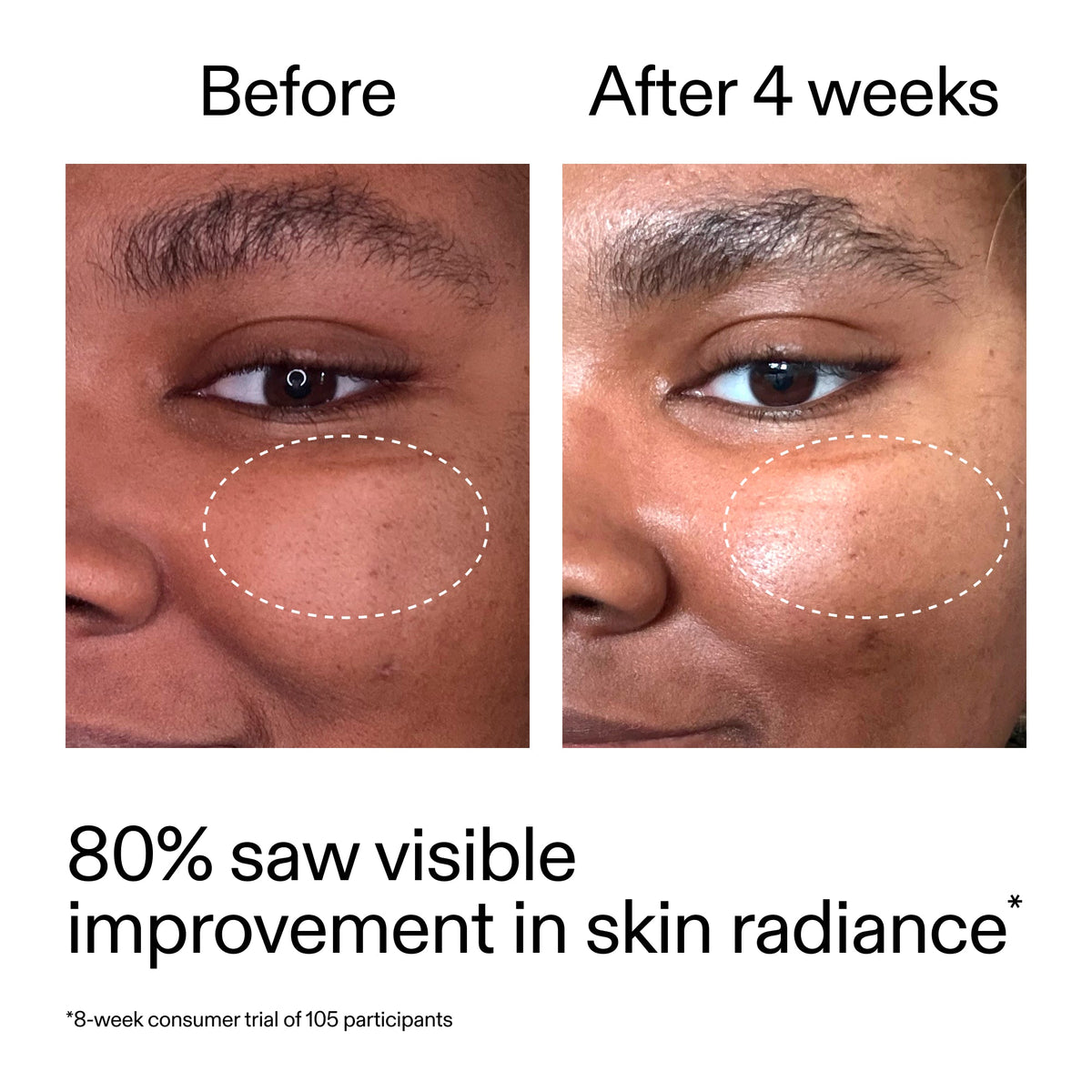 advanced-0-2-retinal-serum-h3 AdvancedRetinal_BeforeAfter_Claim2_2000x2000_39d11e3d-eda9-44ec-ab32-2903b1a368bd.jpg