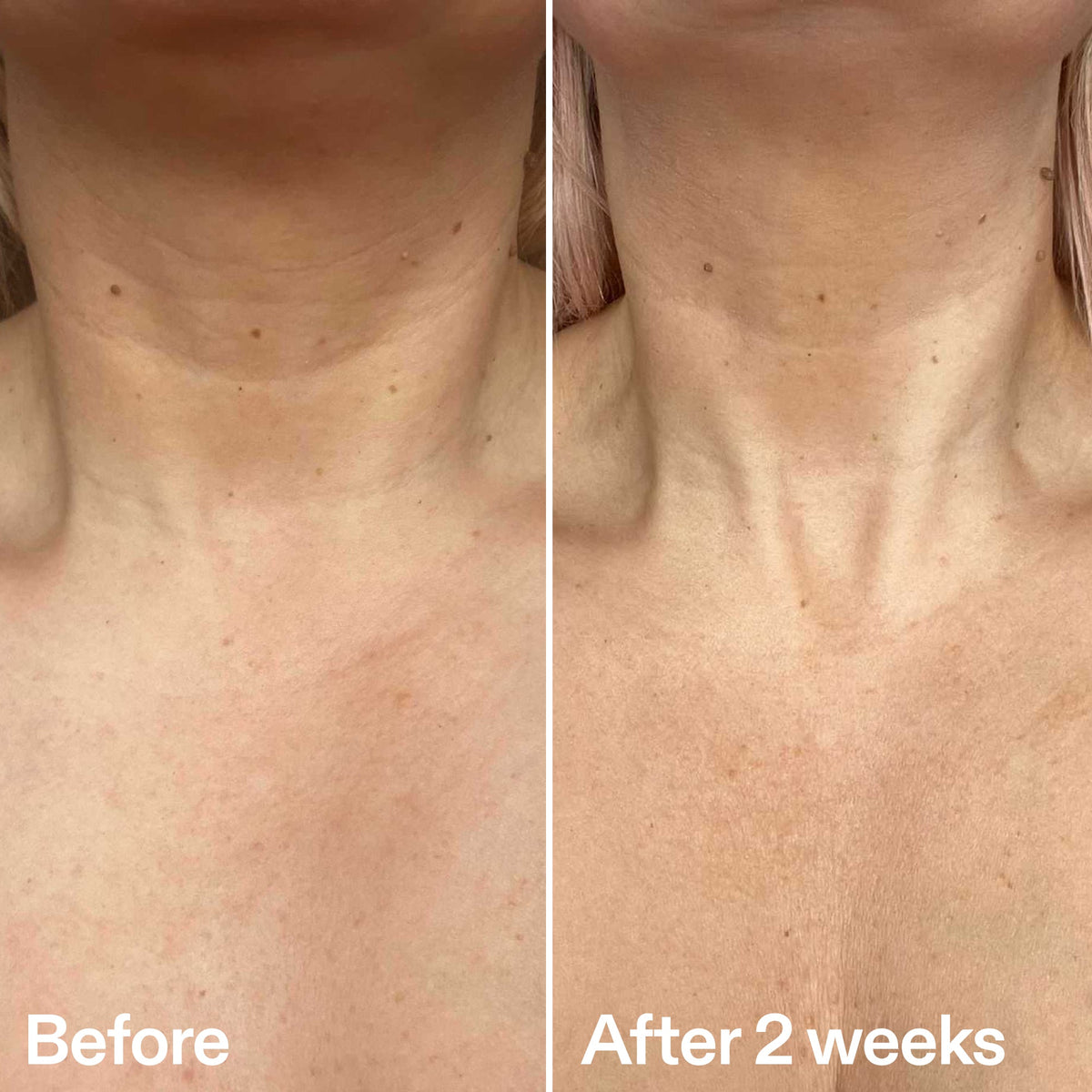 bio-active-neck-lift-stick-p3 B_A_2.jpg