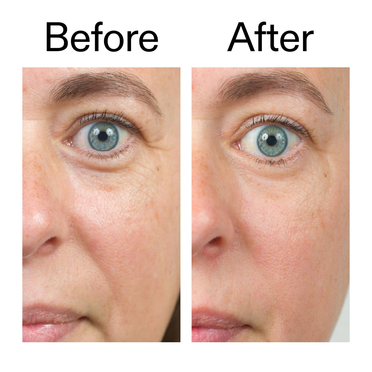 bio-active-ceramide-moisturizer-y2 Bio-Active_Before_After_2000x2000_566e5a9e-135e-417a-8242-b44e5fa35463.jpg