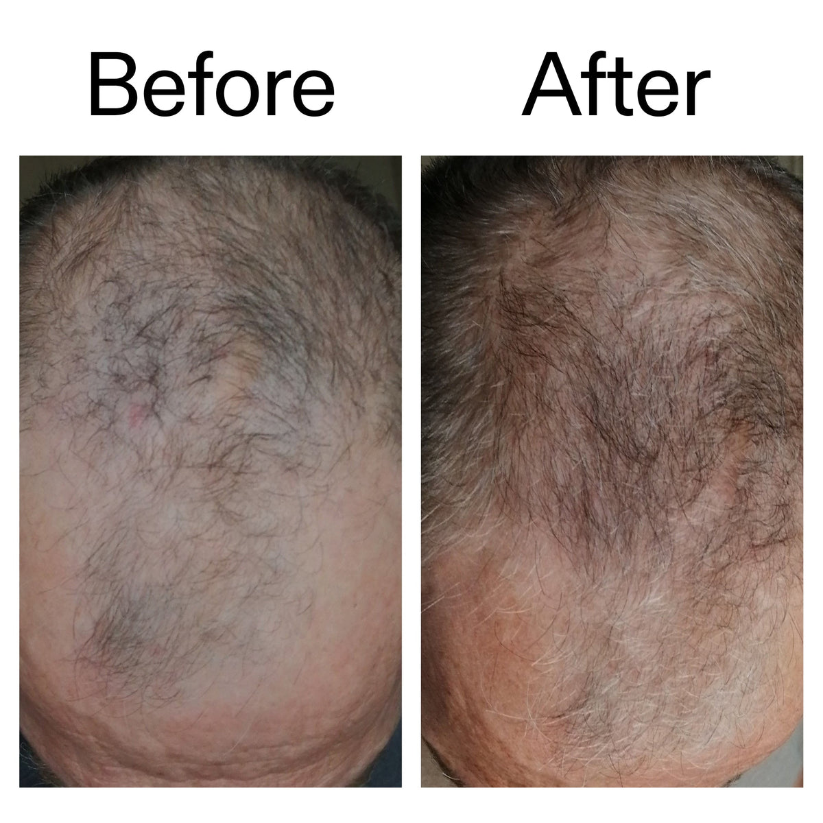 caffeine-stimulating-scalp-treatment-q0 Caffeine_Scalp_Treatment_B_A_Ppage_2000_x_2000.jpg