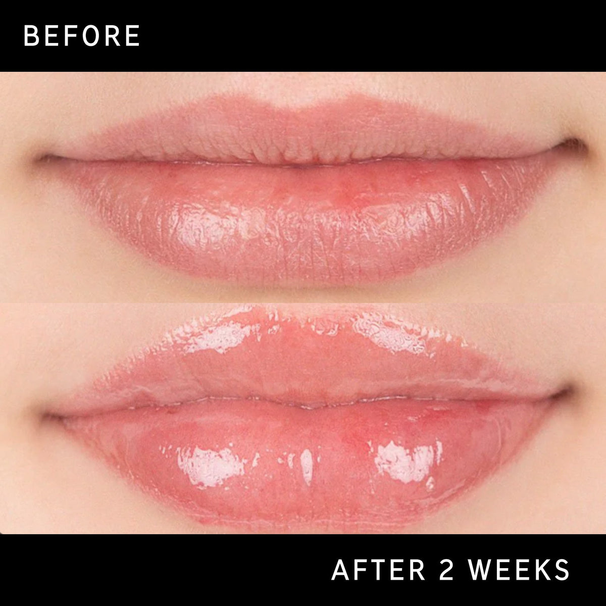 lip-plumping-duo-v8 DTC-Top15_Amends_Tripeptide-Lip_B_A.jpg