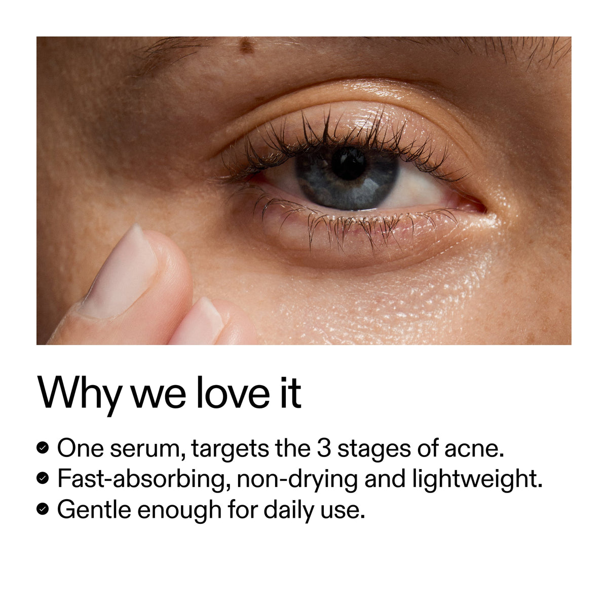 360-acne-clearing-duo-c8 Dioic_Whyweloveit_2000x2000_175aafd3-0cbe-403a-b317-a8362881bfe2.jpg