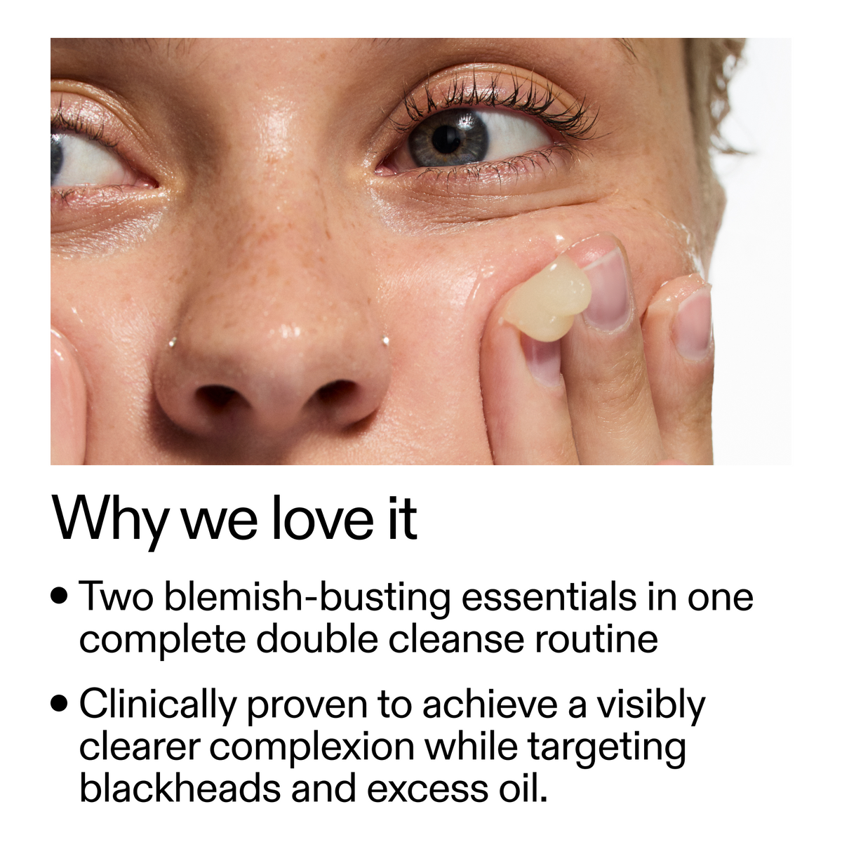 acne-double-cleanse-duo-x0 Double_Cleanse_Duo_for_Breakouts_Why_We_2000x2000_f242cb12-bb5c-487c-b203-071ccb406ec5.png