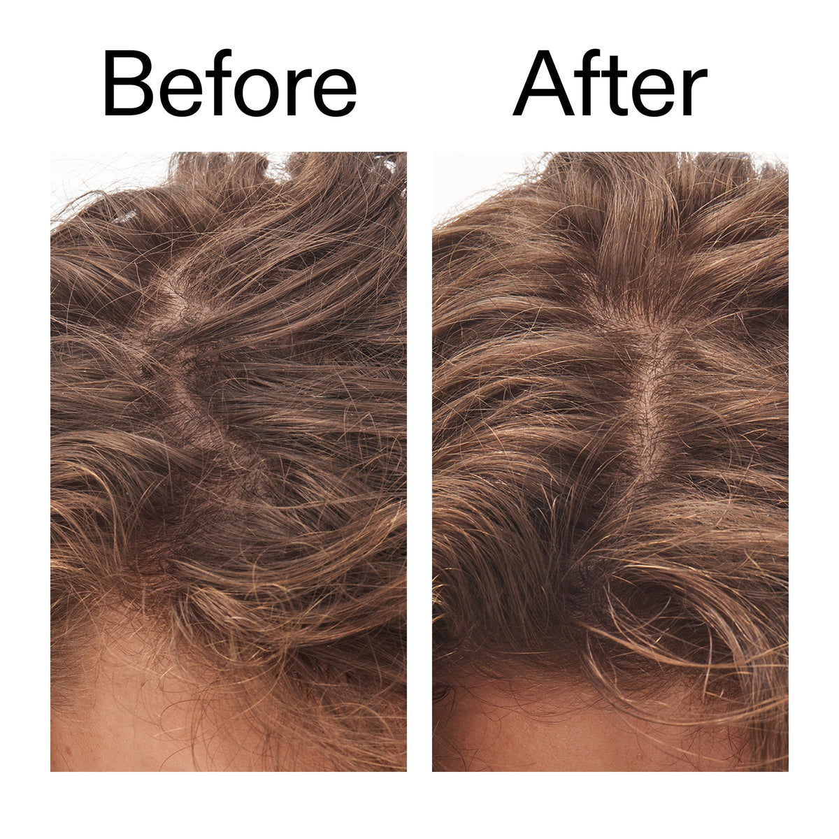 glycolic-acid-exfoliating-scalp-scrub-b3 Glycolic_Acid_Exfoliating_Scalp_Scrub_Before_After_2000x2000_b8561c87-05a1-4caa-80f7-1b6b33d750f7.jpg