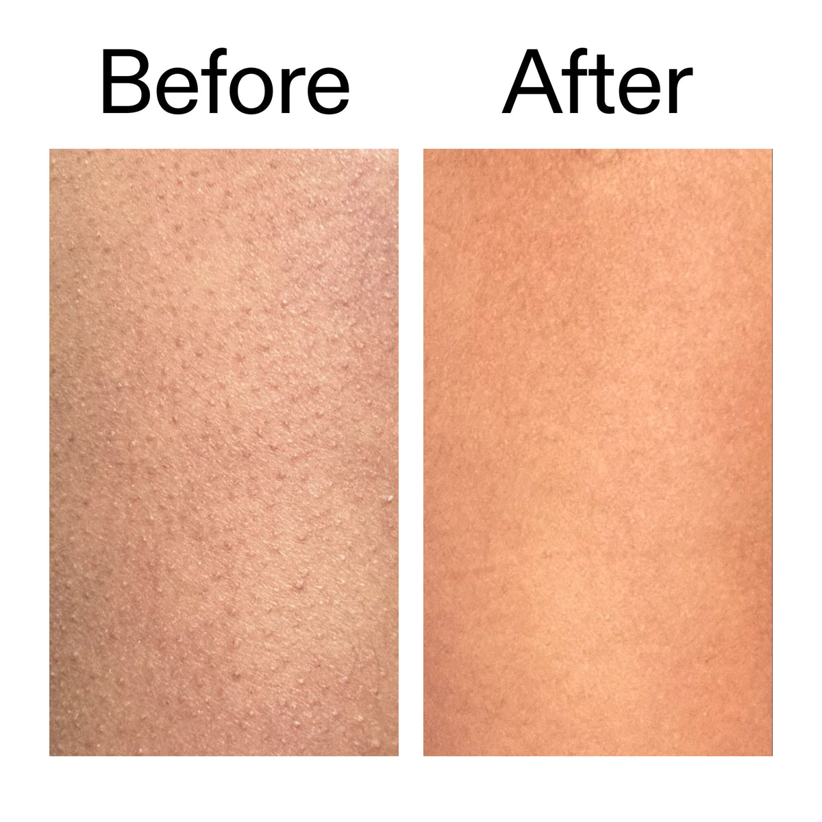 glycolic-acid-exfoliating-body-stick-x4 Glycolic_Body_Stick_B_A_2000x2000_6e6e6b4d-5bd7-43c0-aeed-4d66788e8995.jpg