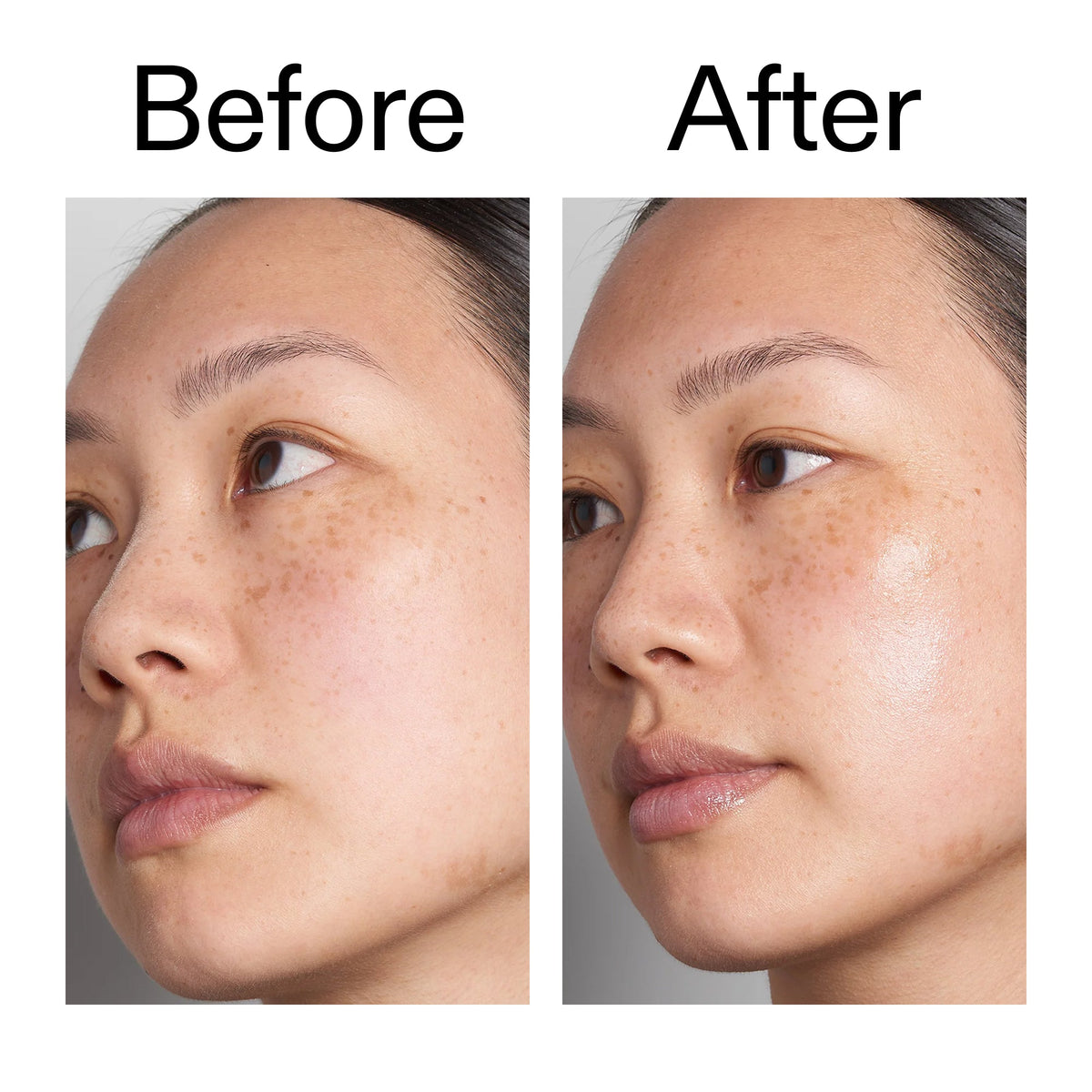 supersize-hyaluronic-acid-serum-100ml-s4 Hyaluronic_Acid_Before_After_2000x2000_d7983956-8aa2-4ea3-8255-c63e8d4f892e.jpg