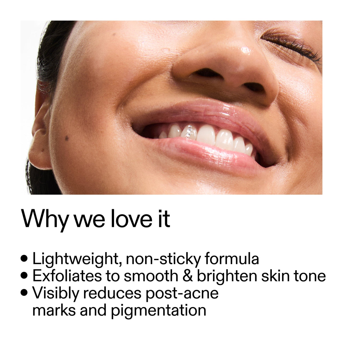 mandelic-acid-treatment-h0 Mandelic_Acid_Treatment_Why_we_love_it_2000x2000_6dfe29a9-2a79-464f-a5e8-e5ac37d93388.jpg