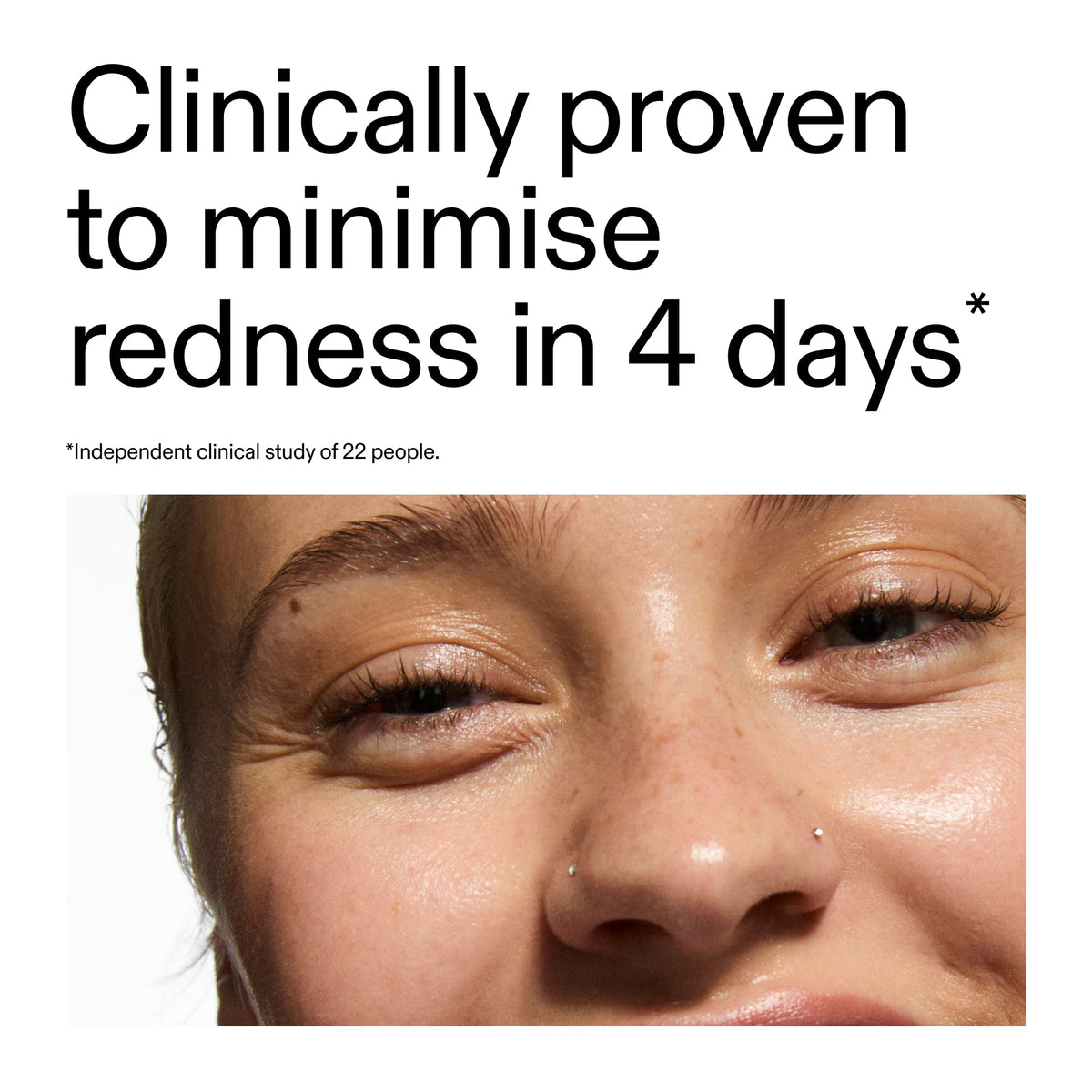 10-azelaic-acid-serum-for-redness-relief-m0 Oat_Cleansing_Balm_Claim_2000x2000_52a841dc-353c-4f2c-8646-3aadb604507d.jpg