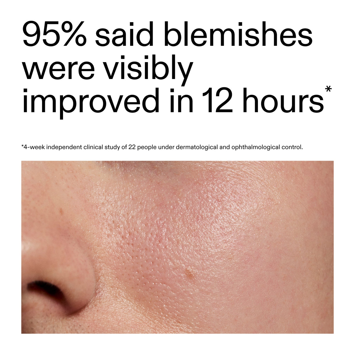 succinic-acid-acne-treatment-t4 Oat_Cleansing_Balm_Claim_2000x2000_ac6ce553-25db-41b2-a981-faae1ac4b8c0.jpg