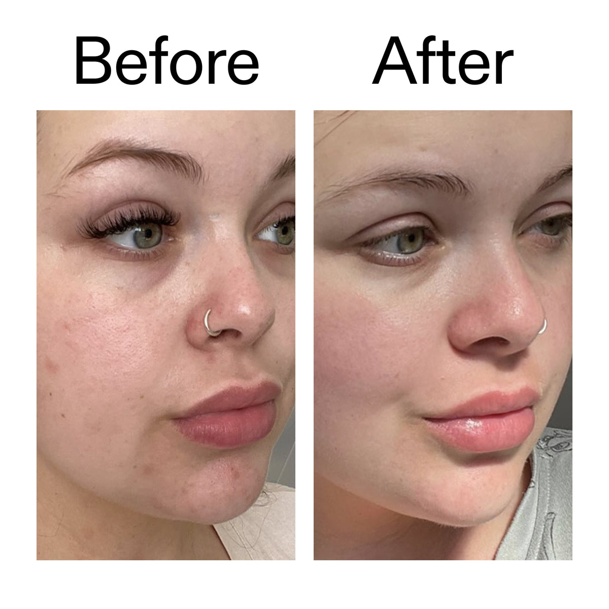 omega-water-cream-50ml-o8 Omega50_Before_After_2000x2000_46483ed8-3f9d-487f-9a0c-9df79830bd65.jpg