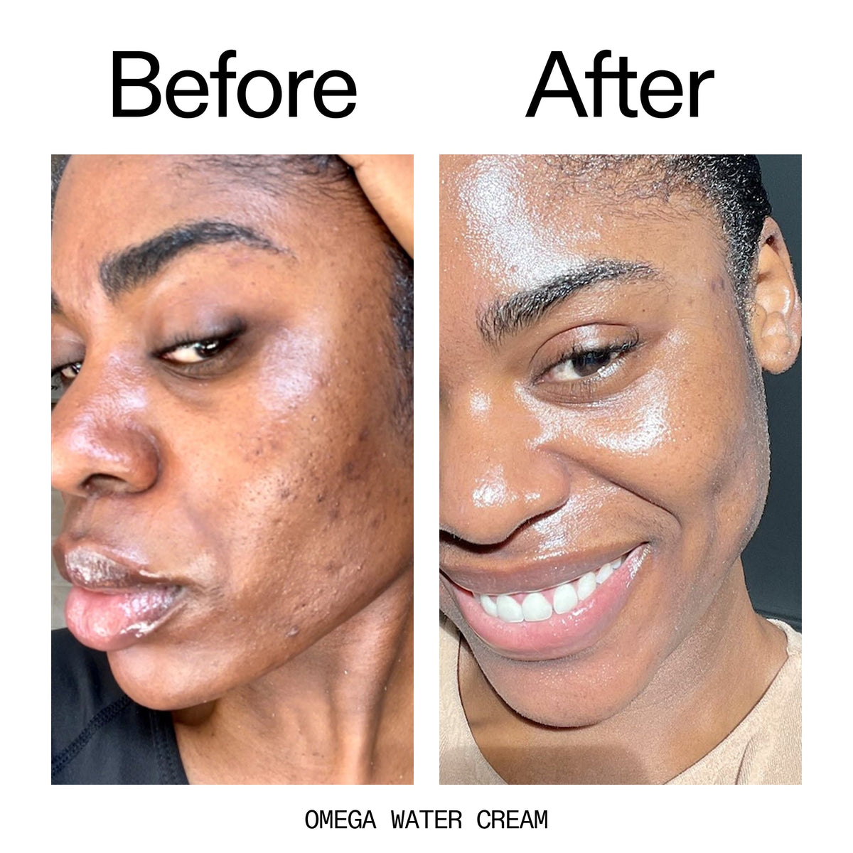 glowing-skin-set-i0 Omega_Water_Cream_Before_After_2000x2000_8e88278b-8c8d-48dc-ac77-4e98ebbd1b77.jpg