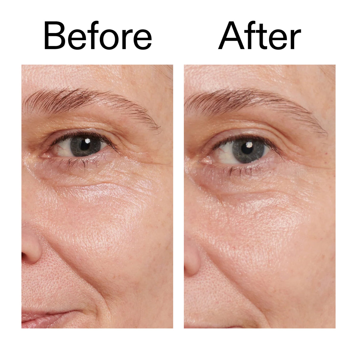 retinol-eye-cream-m0 Retinol_Eye_Cream_Before_After_2000x2000_ac03a80c-109e-4572-a95a-91dc109b4d27.jpg