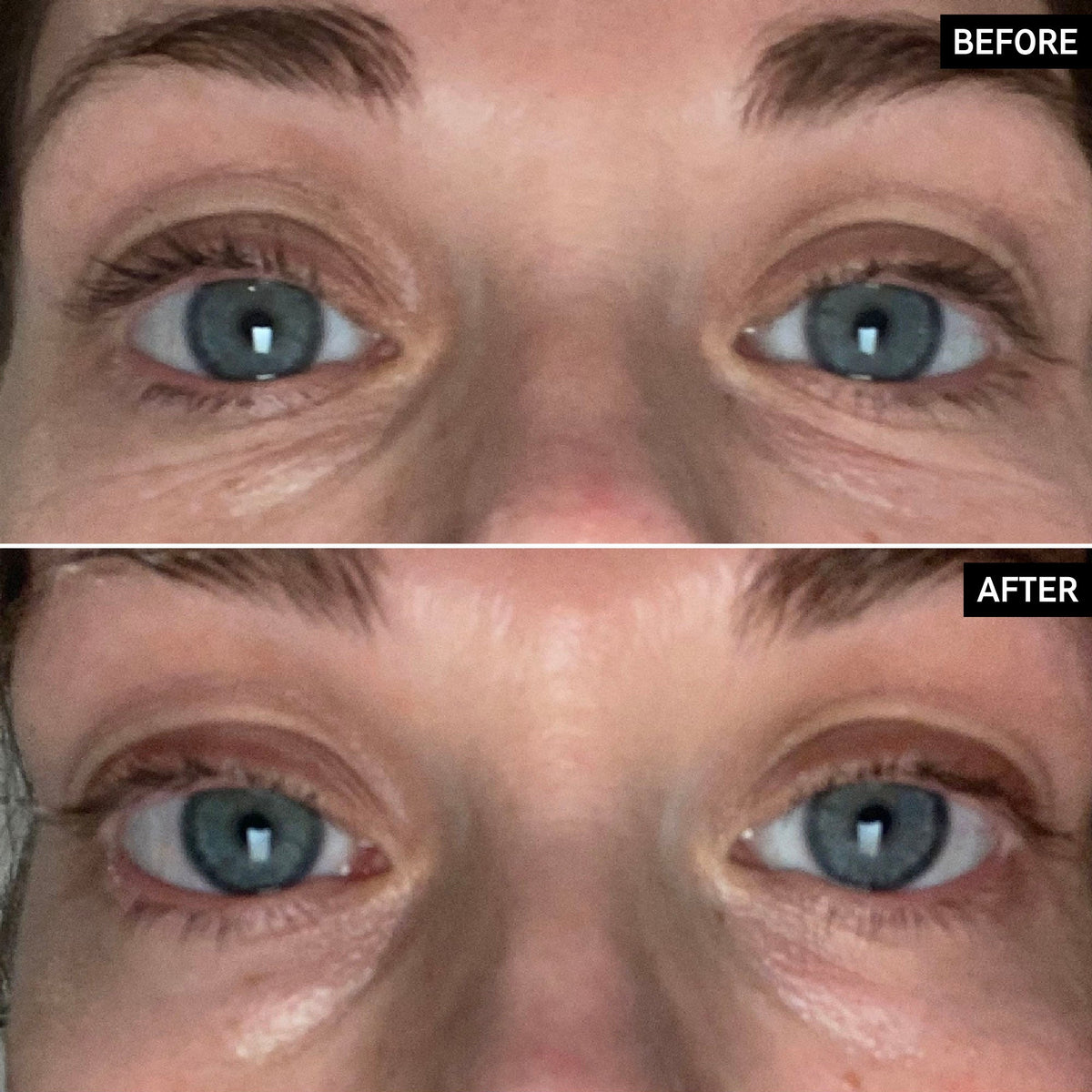 retinol-eye-cream-m0 SITE-UGCBAsApril_Nicole_B_A_PPage_2000x2000_1.jpg
