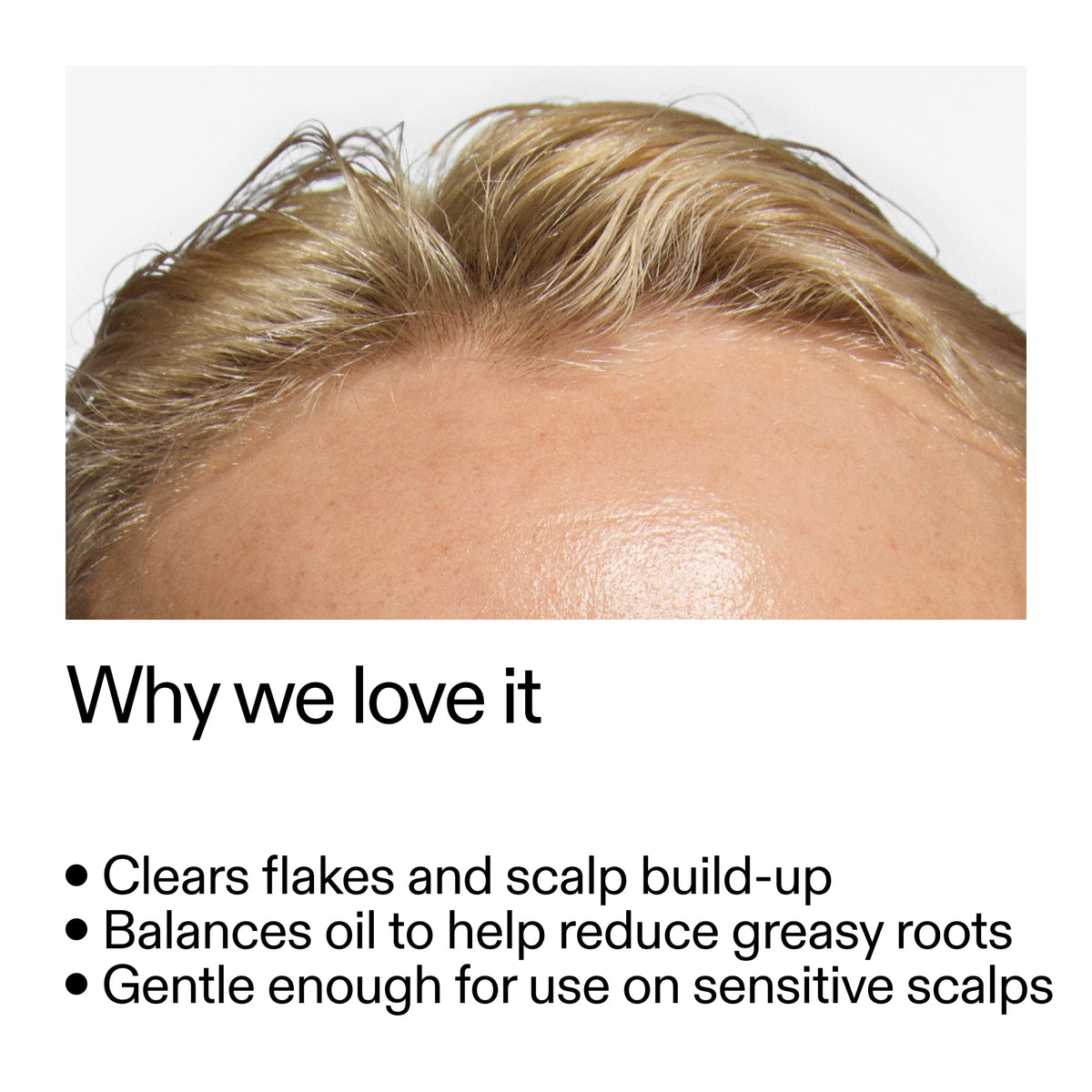 salicylic-acid-exfoliating-scalp-treatment-h5 Salicylic_Acid_Exfoliating_Scalp_Treatment_Why_we_love_it_2000x2000_44b6bd6d-9ec4-4b23-9dc4-bc3fd6f28e14.jpg