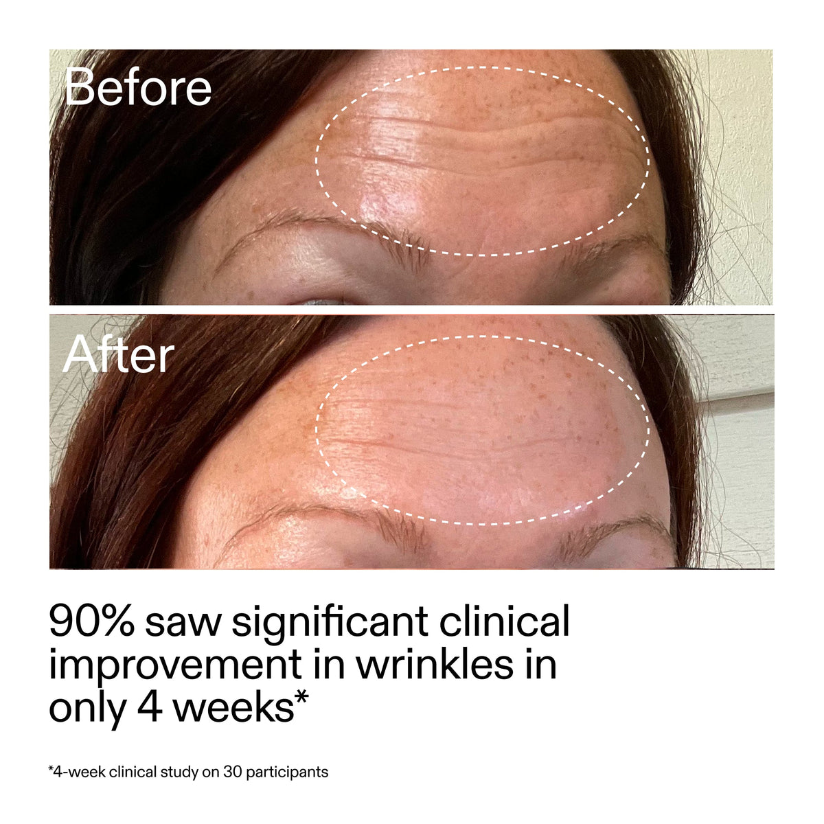 starter-retinol-serum-duo-b0 StarterRetinol_BeforeAfter_Claim1_2000x2000_03b4d6e5-a357-43b9-a855-aba5e35c57f3.jpg