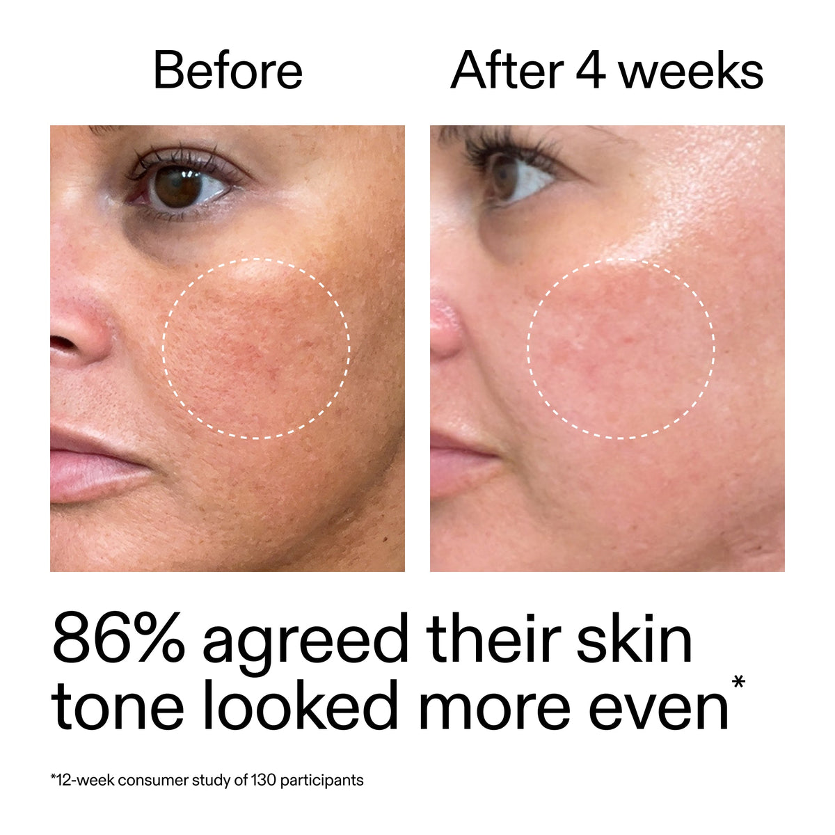 starter-retinol-serum-x3 StarterRetinol_BeforeAfter_Claim2_2000x2000_f5c9ecc0-8d76-429d-bef5-c3a61bcf5c09.jpg