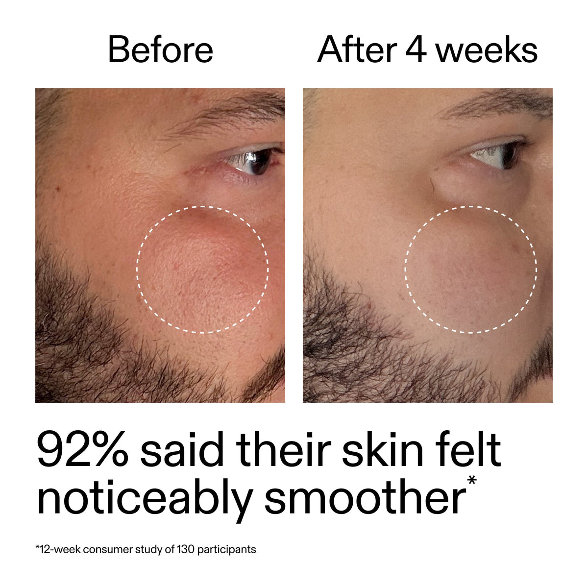 starter-retinol-serum-duo-b0 StarterRetinol_BeforeAfter_Claim3_2000x2000_458243a8-bbb0-4e5d-a274-29c7766d339b.jpg