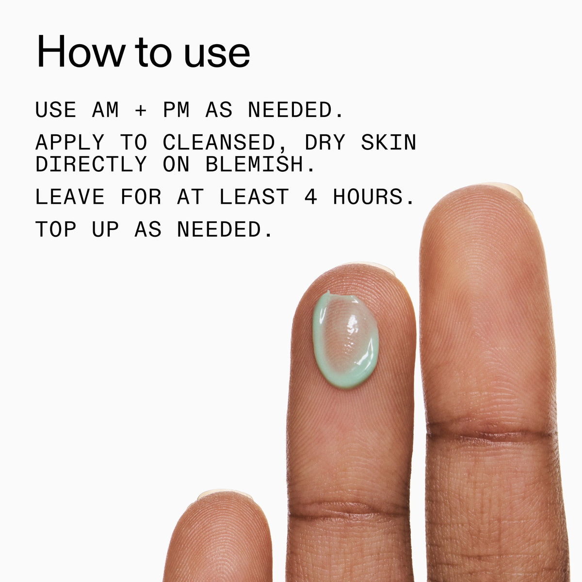 succinic-acid-acne-treatment-t4 Succinic_Acid_Treatment_How_to_Use_2000x2000_d57137d5-d7f1-427c-9a46-5fc00c19c542.jpg