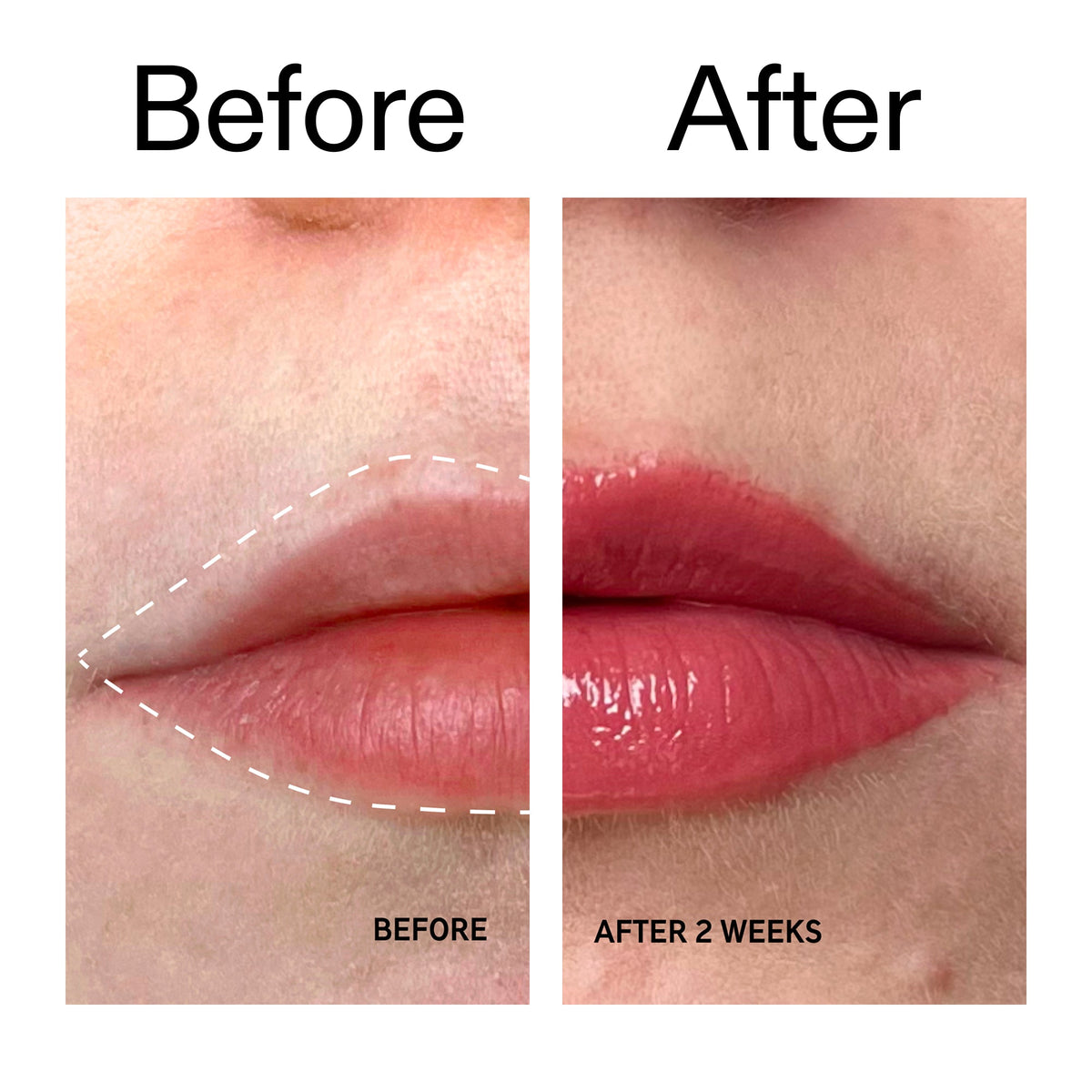 tripeptide-plumping-berry-lip-balm-d7 Tripeptide_Plumping_Lip_Balm_-_Berry_Before_After_2000x2000_9474bbd8-43ca-4b0e-b0e7-dfab70b91927.jpg