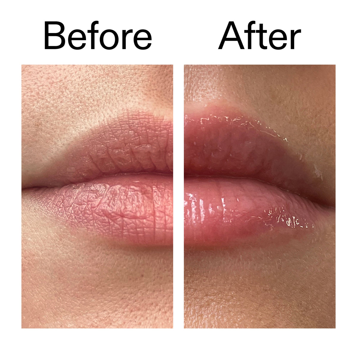 lip-plumping-duo-v8 Tripeptide_Plumping_Lip_Balm_Before_After_2000x2000_b4a5ee04-d2ac-4857-8f01-17209acc4bf3.jpg
