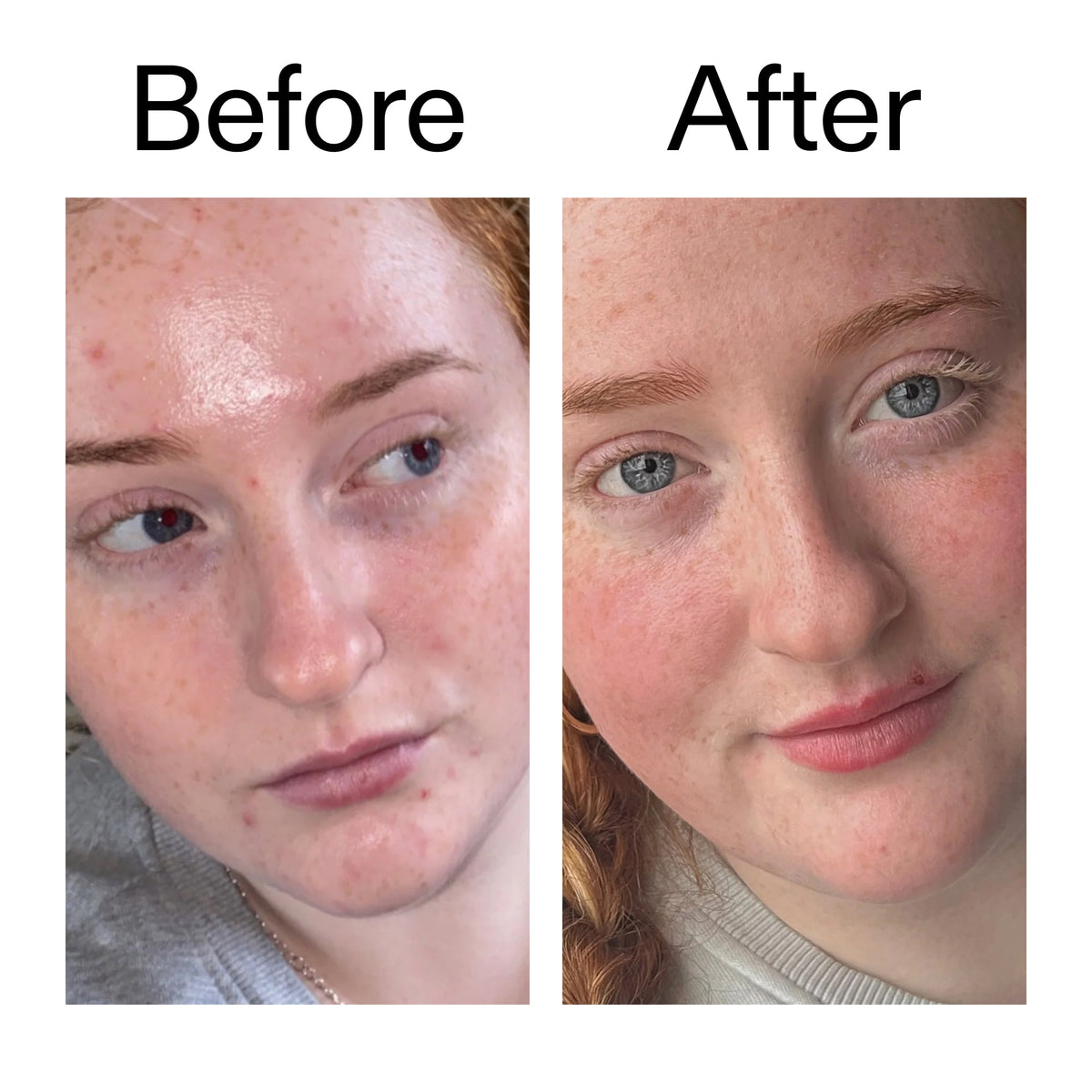 vitamin-b-c-and-e-moisturizer-j8 Vitamin_B_C_and_E_Moisturizer_Before_After_2000x2000_b0781a76-5ad2-4be9-95b8-ef92b356833c.jpg